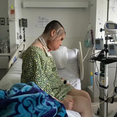 katie after the transplantation