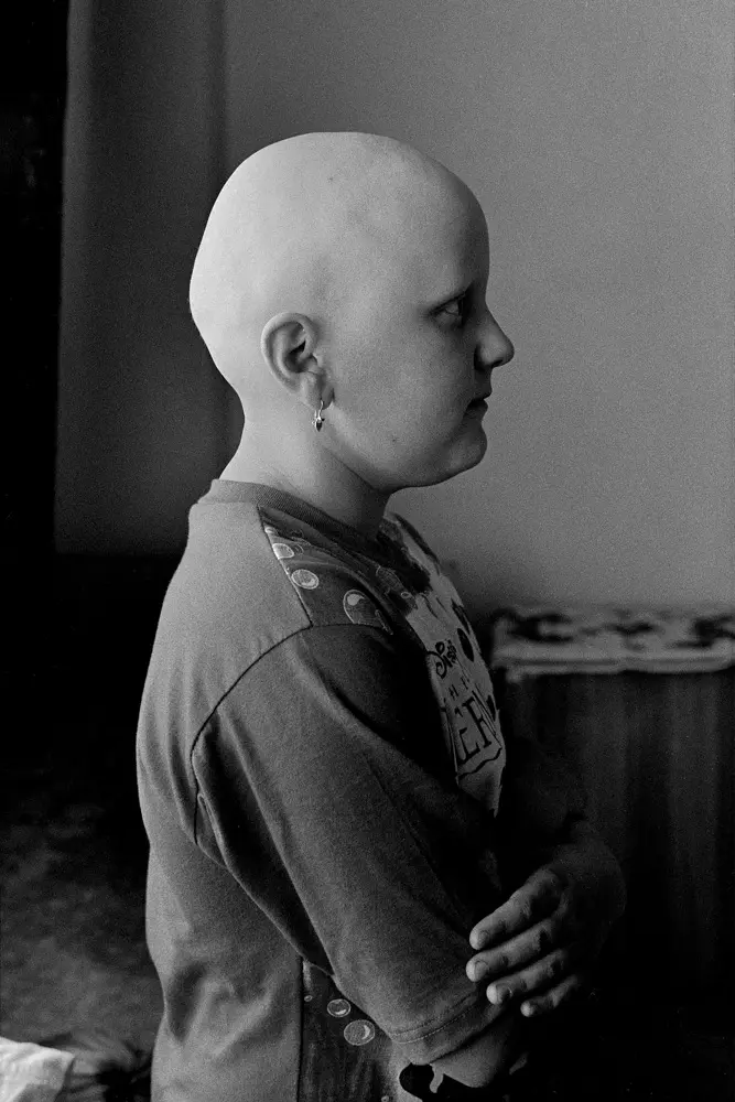 Chernobyl by Yoshino Oishi