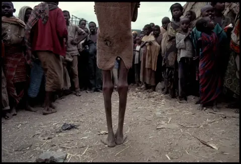legs of a starving human