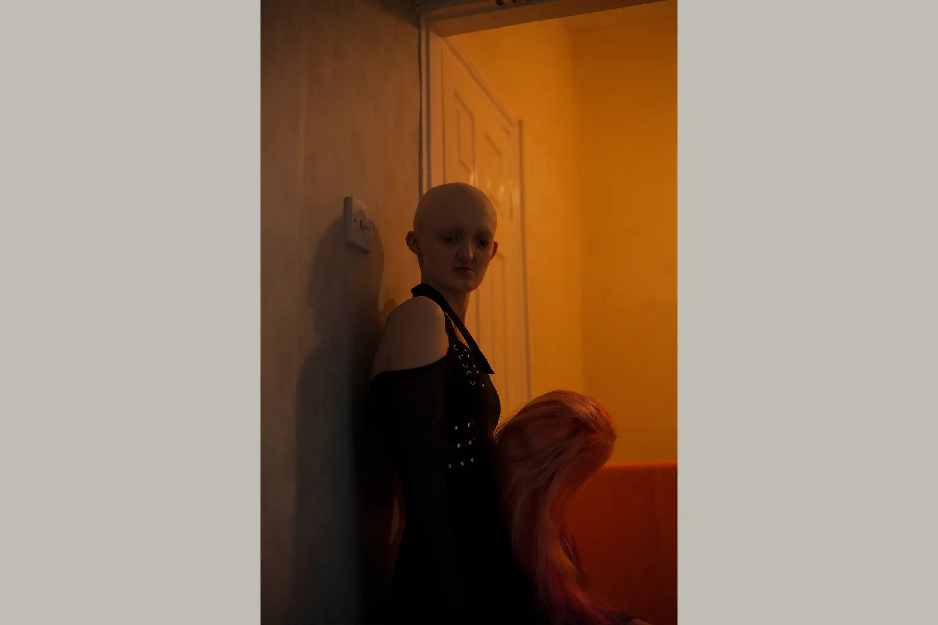 Woman with bald head and wig in hand