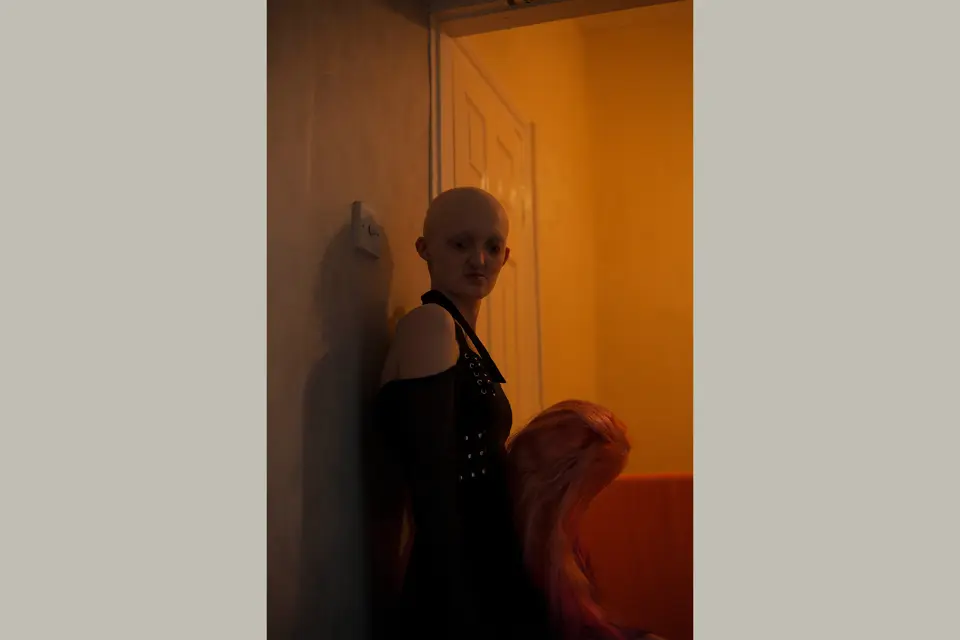 Hannah standing in the quiet light of her bedroom corridor, reveals a mix of strength and vulnerability. Her wig gives her comfort in a world still learning to embrace diversity.
